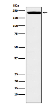 ZEB1 Recombinant Rabbit Monoclonal Antibody