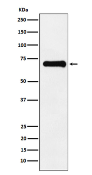 Phospho-PAK4/5/6 (Ser474/Ser602/Ser560) Recombinant Rabbit Monoclonal Antibody