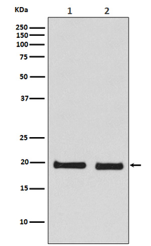 SKP1 Recombinant Rabbit Monoclonal Antibody