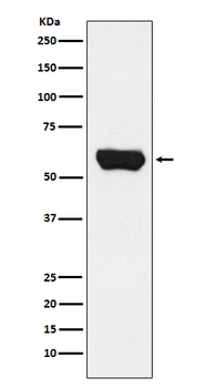 LCK Recombinant Rabbit Monoclonal Antibody
