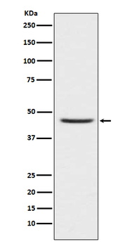 CCR8 Recombinant Rabbit Monoclonal Antibody
