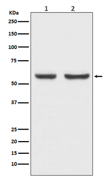 CCBR1 Recombinant Rabbit Monoclonal Antibody