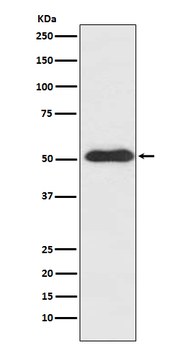SLIT2 Recombinant Rabbit Monoclonal Antibody