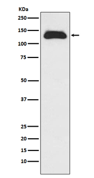 KIF11 Recombinant Rabbit Monoclonal Antibody