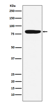 Coagulation factor XIII A Recombinant Rabbit Monoclonal Antibody