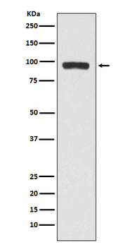 BCHE Recombinant Rabbit Monoclonal Antibody