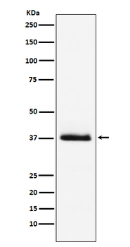 Parathyroid hormone Recombinant Rabbit Monoclonal Antibody