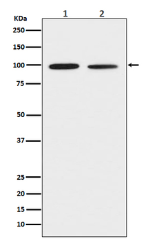 CD167b/DDR2 Recombinant Rabbit Monoclonal Antibody