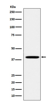 Folate Receptor alpha Recombinant Rabbit Monoclonal Antibody