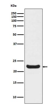 RBP4 Recombinant Rabbit Monoclonal Antibody