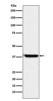 OGG1 Recombinant Rabbit Monoclonal Antibody