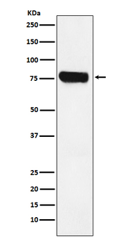 HEC1 Recombinant Rabbit Monoclonal Antibody