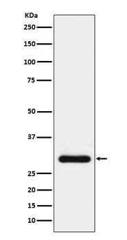 BNP Recombinant Rabbit Monoclonal Antibody