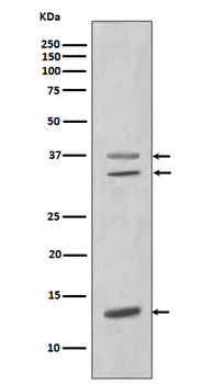 CEBP beta Recombinant Rabbit Monoclonal Antibody
