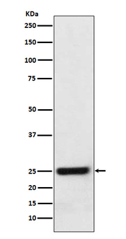 HSD17B10 Recombinant Rabbit Monoclonal Antibody