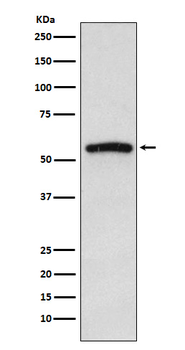IRAK4 Recombinant Rabbit Monoclonal Antibody