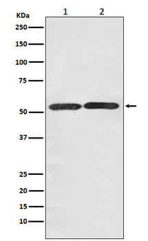 GLUT3 Recombinant Rabbit Monoclonal Antibody