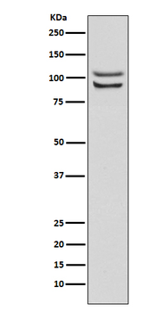 FGFR4 Recombinant Rabbit Monoclonal Antibody