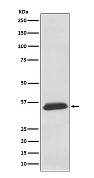 Delta Sarcoglycan Recombinant Rabbit Monoclonal Antibody