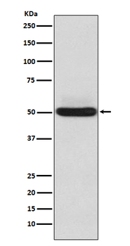 Alpha Sarcoglycan Recombinant Rabbit Monoclonal Antibody