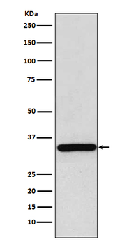 Gamma Sarcoglycan Recombinant Rabbit Monoclonal Antibody