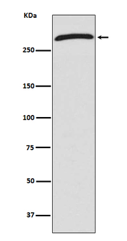 CHD4 Recombinant Rabbit Monoclonal Antibody