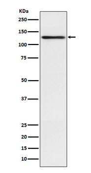 Involucrin Recombinant Rabbit Monoclonal Antibody