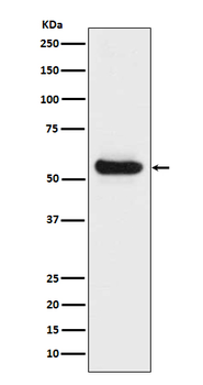 Lipoprotein lipase Recombinant Rabbit Monoclonal Antibody
