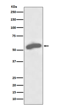 Glucose 6 Phosphate Dehydrogenase Recombinant Rabbit Monoclonal Antibody