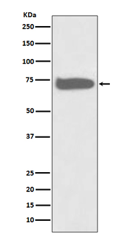 GCLC Recombinant Rabbit Monoclonal Antibody