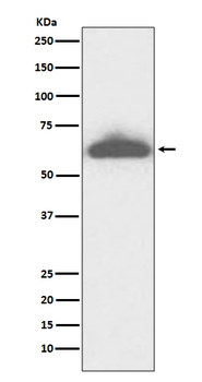 RPE65 Recombinant Rabbit Monoclonal Antibody
