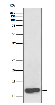 SAA1 Recombinant Rabbit Monoclonal Antibody