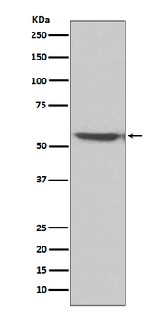 PPP3CA Recombinant Rabbit Monoclonal Antibody