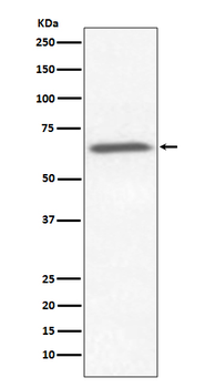Ku70 / XRCC6 Recombinant Rabbit Monoclonal Antibody