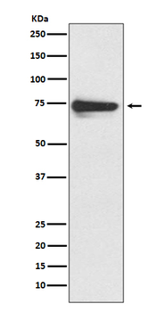 Tyrosinase Recombinant Rabbit Monoclonal Antibody