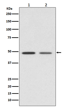 Vitamin D3 receptor Recombinant Rabbit Monoclonal Antibody