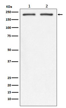 Integrin beta 4/CD104 Recombinant Rabbit Monoclonal Antibody