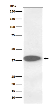 Cathepsin B Recombinant Rabbit Monoclonal Antibody