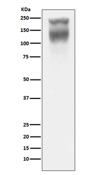CEACAM5 Recombinant Rabbit Monoclonal Antibody