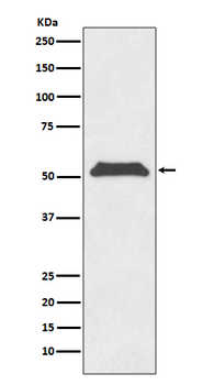 TERF1 Recombinant Rabbit Monoclonal Antibody