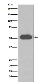 Vitamin D binding protein Recombinant Rabbit Monoclonal Antibody