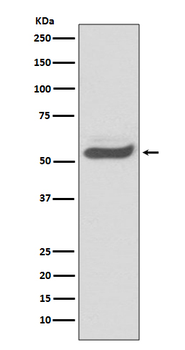 AAT Recombinant Rabbit Monoclonal Antibody
