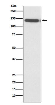 Ctip2 Recombinant Rabbit Monoclonal Antibody