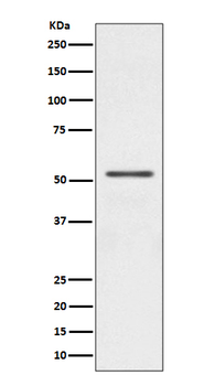 Parkin Recombinant Rabbit Monoclonal Antibody