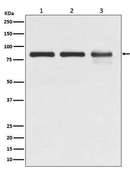 Gamma Catenin Recombinant Rabbit Monoclonal Antibody