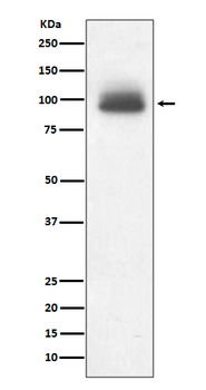 Glucocorticoid receptor Recombinant Rabbit Monoclonal Antibody