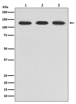 ABL2 Recombinant Rabbit Monoclonal Antibody