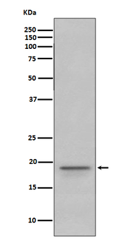 MBP Recombinant Rabbit Monoclonal Antibody
