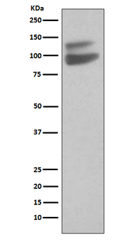 CD144/VE Cadherin Recombinant Rabbit Monoclonal Antibody