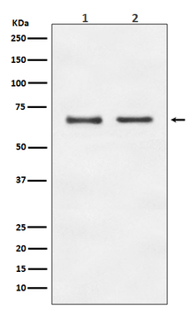 E2F1 Recombinant Rabbit Monoclonal Antibody